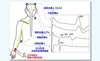 研究例 イメージ